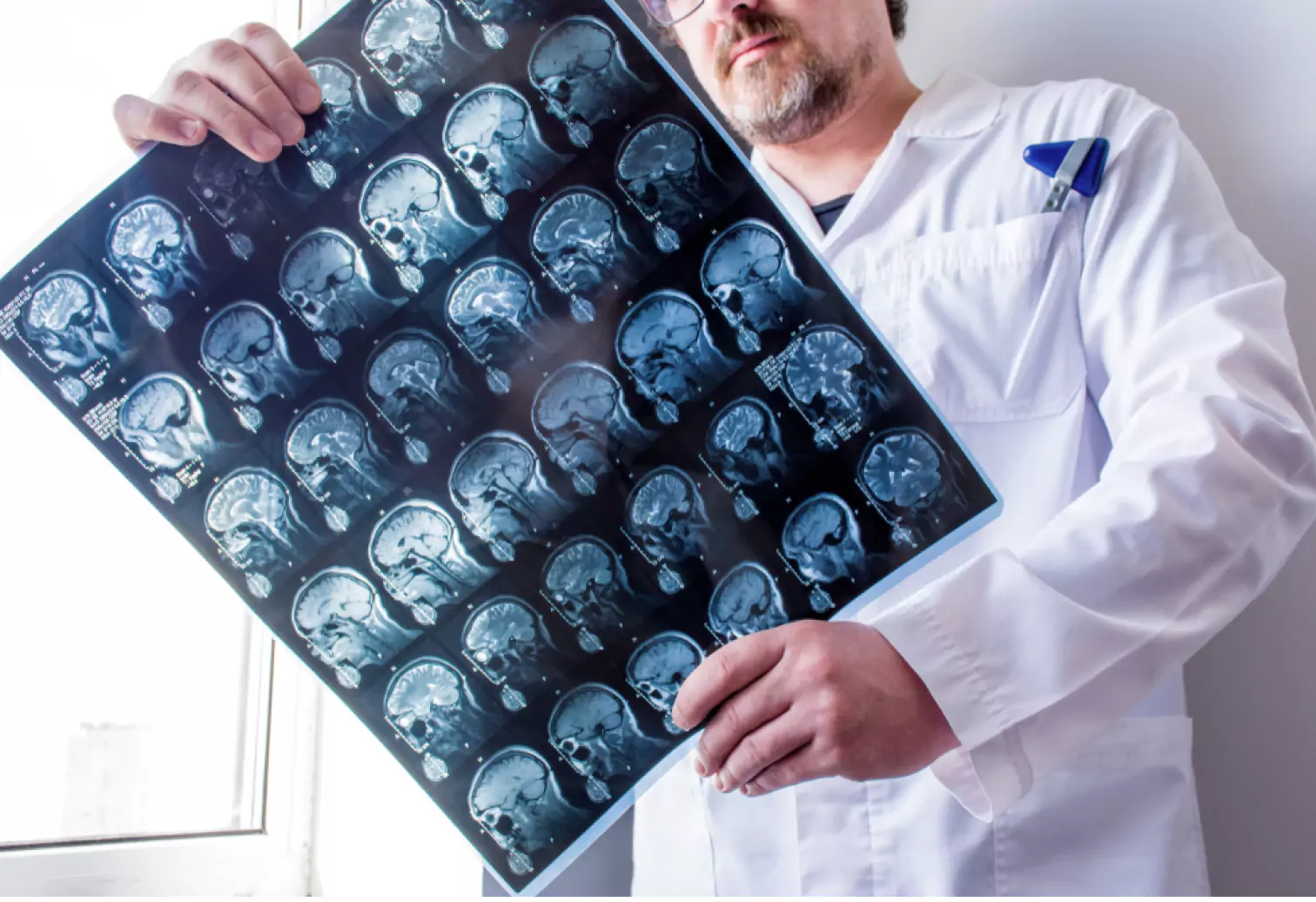 a doctor looking at head scans