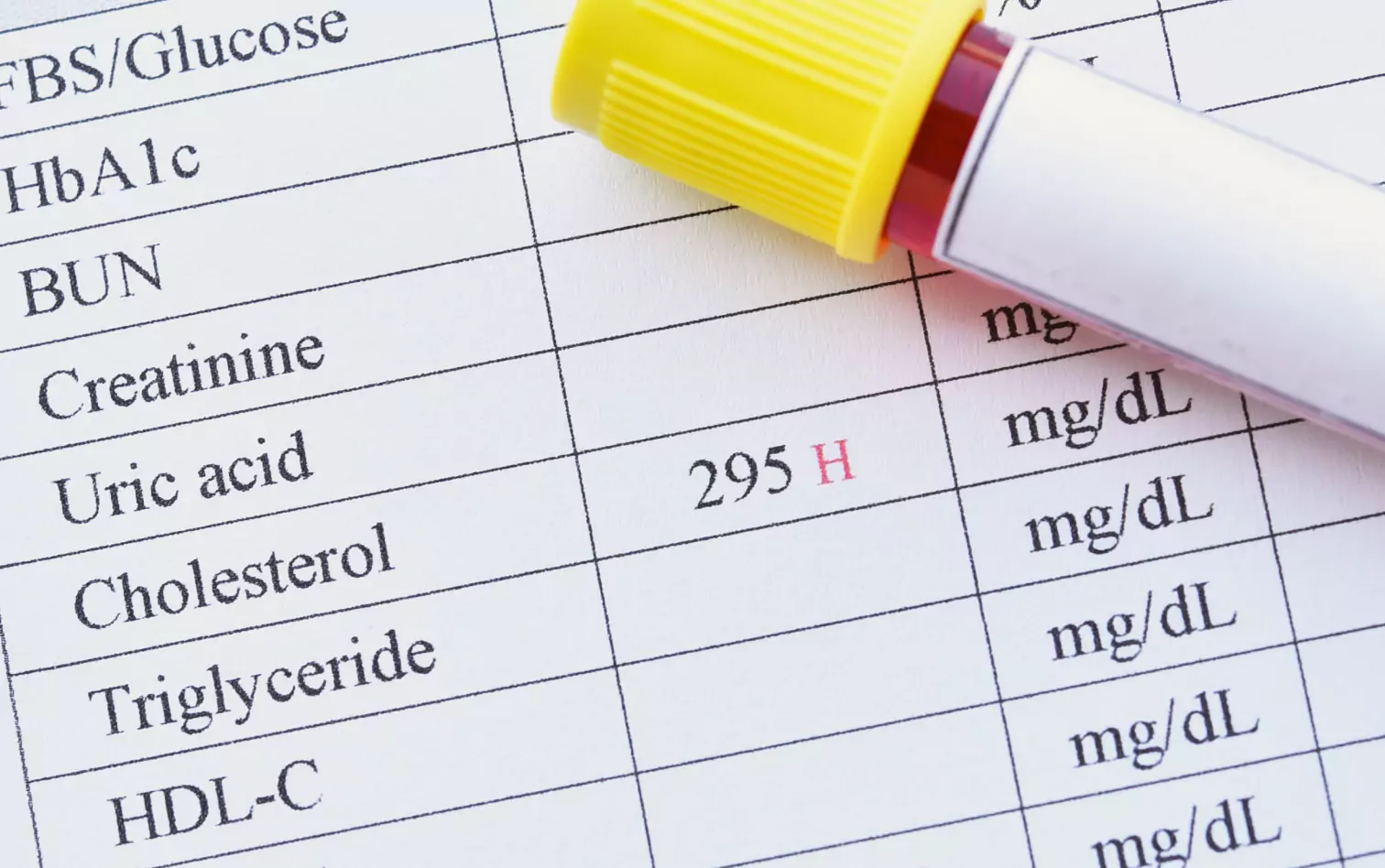 a test tube on a cholesterol result test