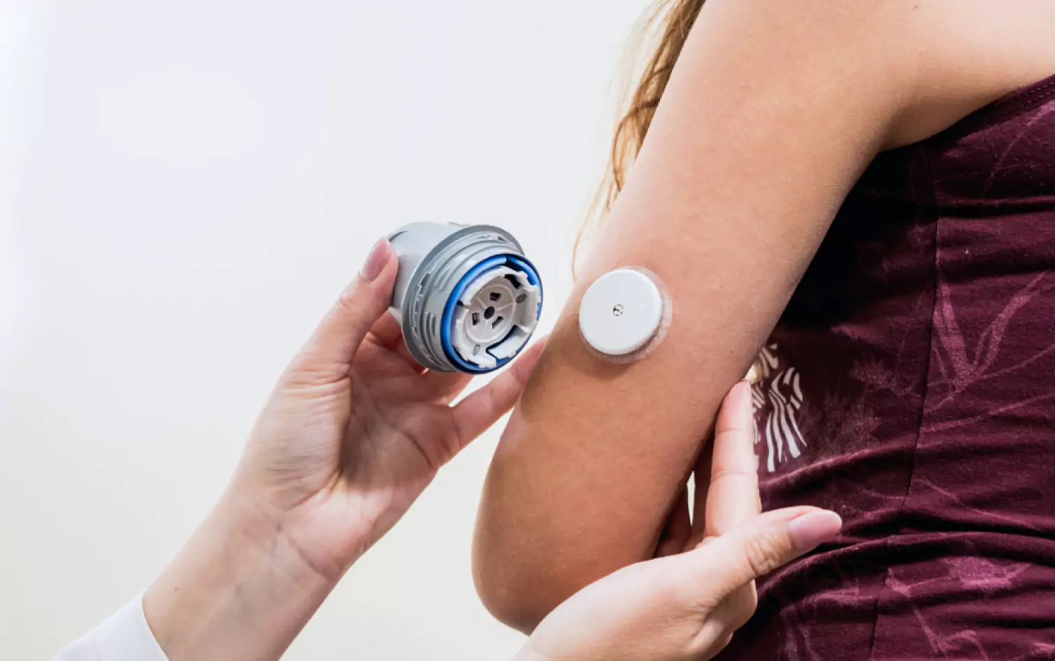 a person being applied a CGM sensor to their upper arm 