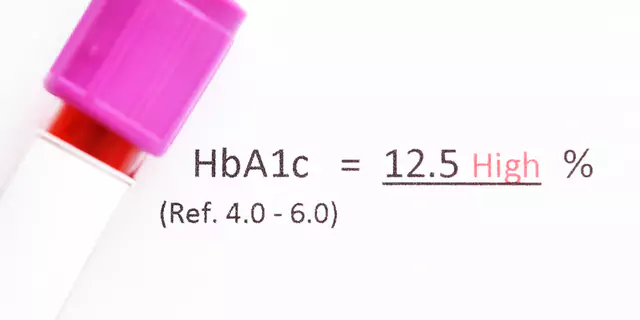 a test tube and HbA1c equal 12.5 High % (Ref. 4.0-6.0)