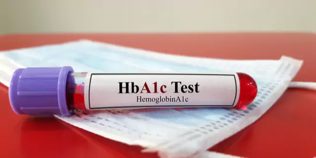 a test tube with HbA1c Test Haemoglobin A1c written on it