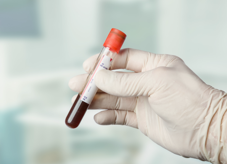 Blood test vial