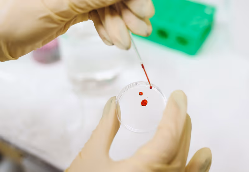Petri dish with blood in it