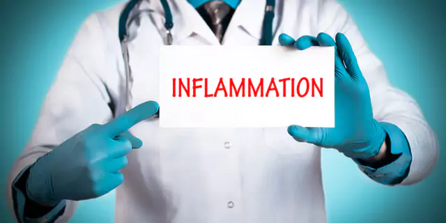 a doctor a sign that says "Inflammation"