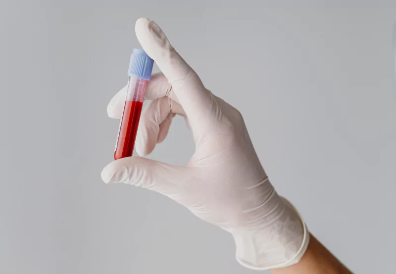 a doctor holding a vial of blood