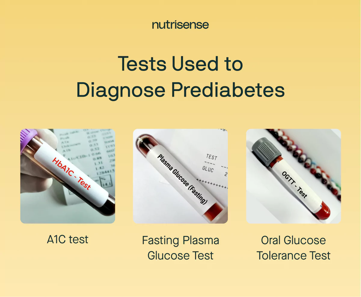 tests used to diagnose prediabetes