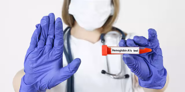 a doctor showing a test tube for haemoglobin A1c test