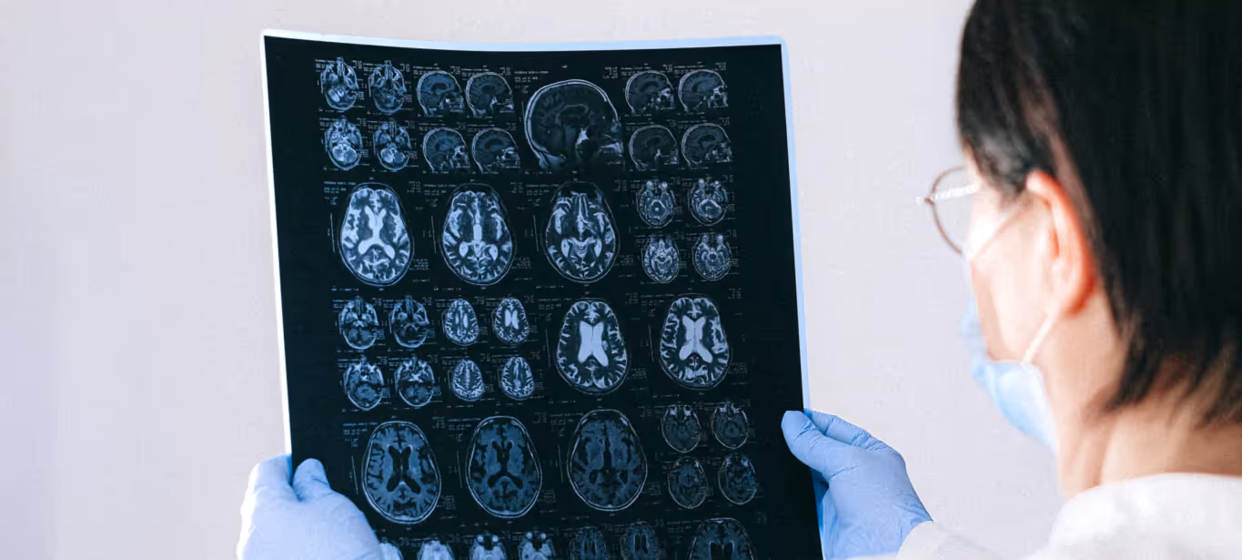 A doctor looking at a brain scan