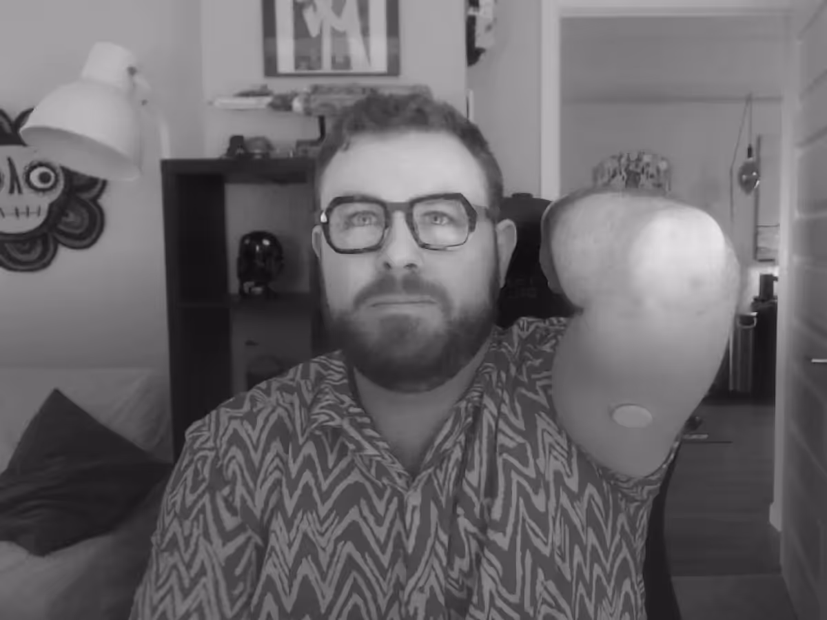 Logan sitting in front of a computer with right arm raised to show his CGM
