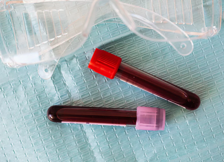 two vials of blood