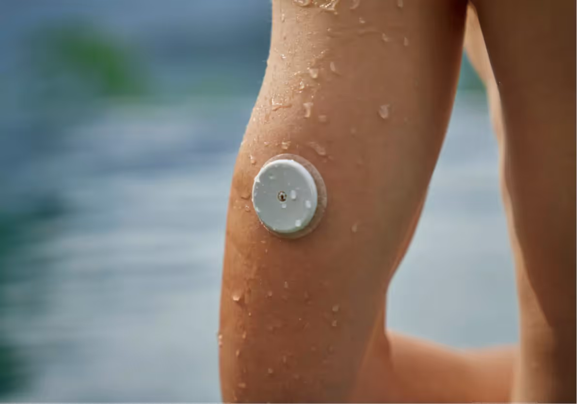 a person wearing a CGM outdoors near the water likely at the beach