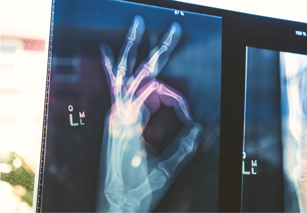 an xray of a hand