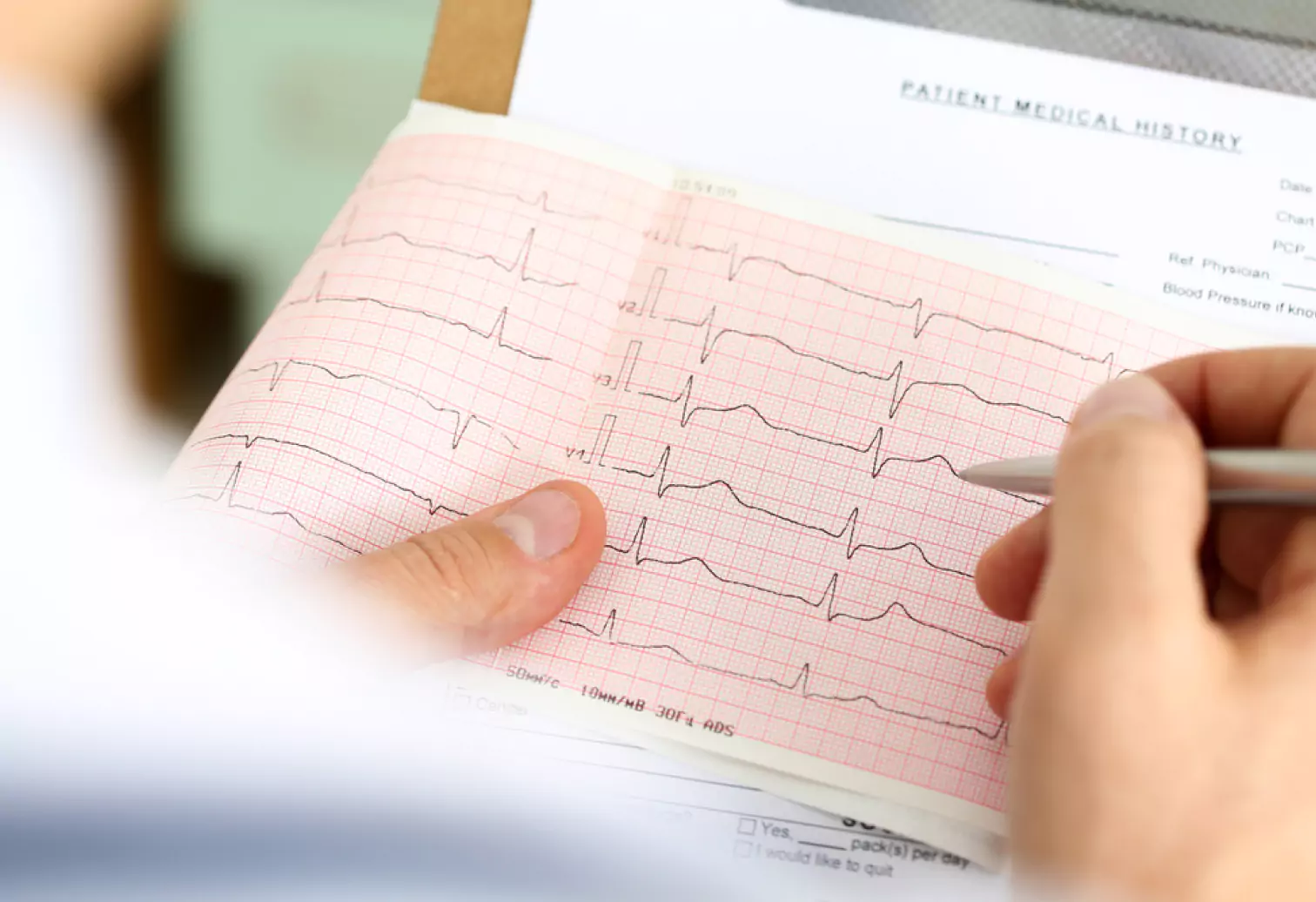 a doctor checking HRV results