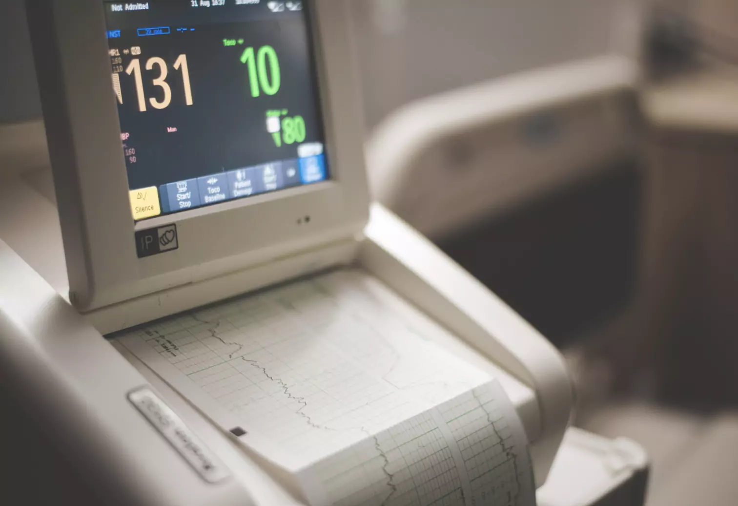 an ECG recording machine