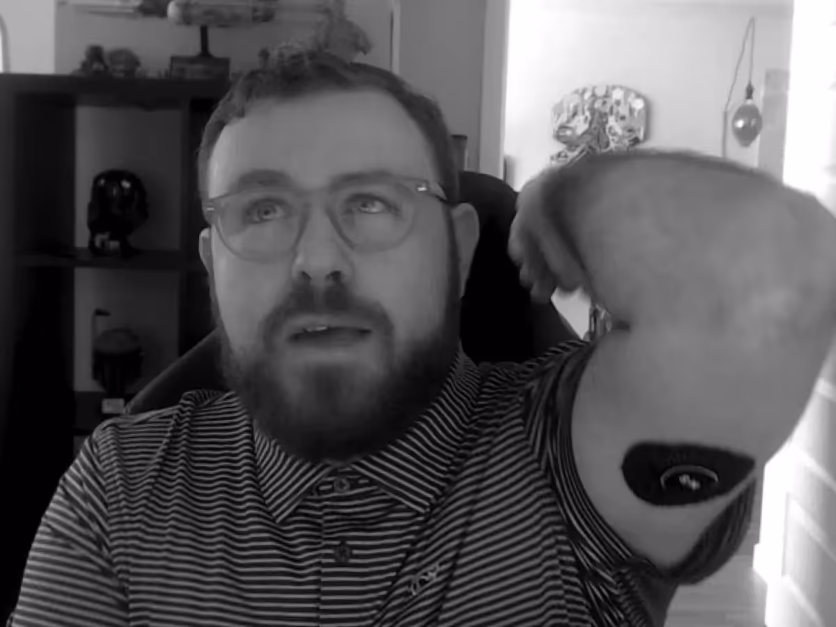 Logan sitting in front of a computer with right arm raised to show his CGM
